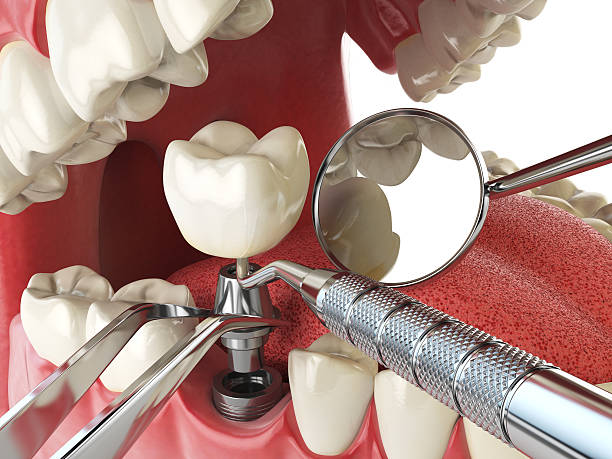 Best Emergency Treatment for Toothache in Spring Valley, AZ